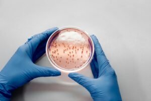 Close-up of gloved hands holding a petri dish with bacterial cultures for scientific analysis.